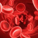 Анемия повышает риск смерти от инсульта Анемия